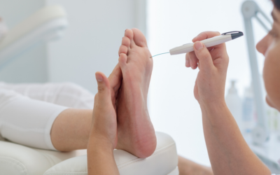 NUELEV Diabetic Peripheral Neuropathy Study